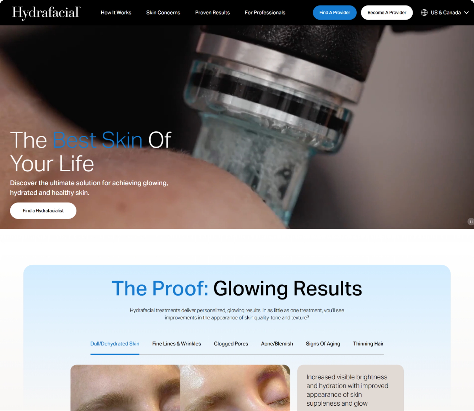 Hydrafacial